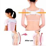 قوز بند طبی استاندارد، درمان قوز کمر - تصویر 4